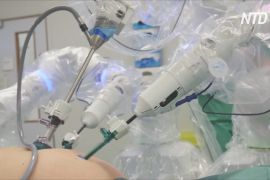 Британський робот-хірург Versius провів уже понад 1000 операцій