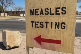 У США вперше за 10 років зареєстрували смерть від кору
