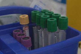 Новий тест рятує від болю за непереносності глютену