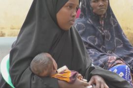 Спалах дифтерії в Сомалі виходить з-під контролю