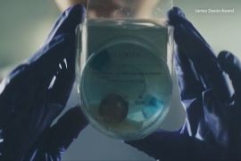 Таблетку для унітаза, яка допомагає виявити хвороби нирок, винайшли у Великій Британії