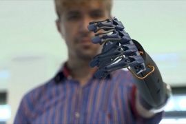 Інженери в Мексиці створили простий у використанні роботизований протез